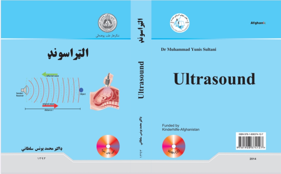 الټراساونډ