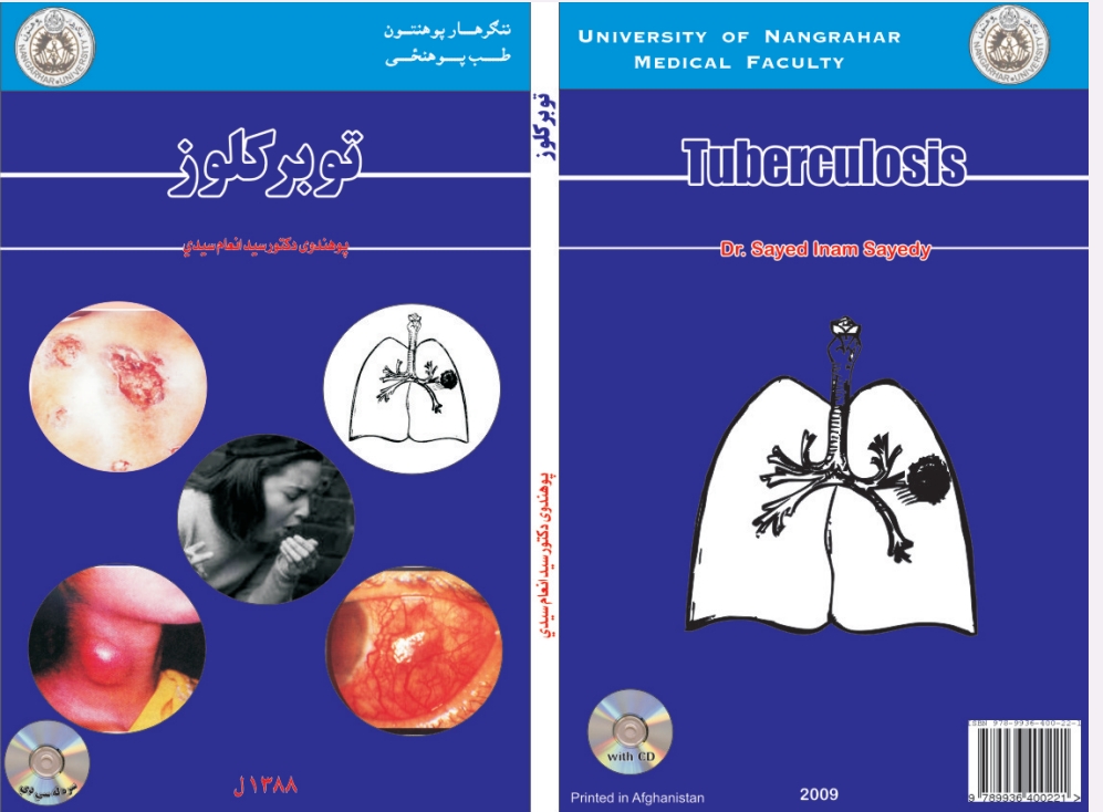توبز کلوز