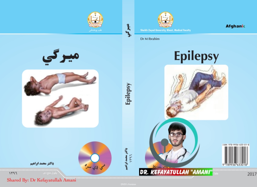میرگي