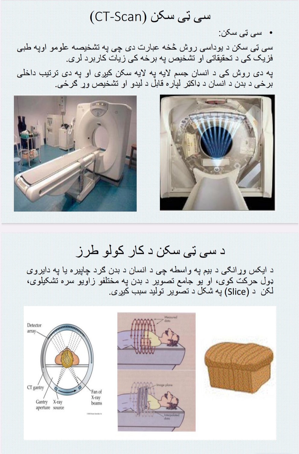 سي ټي سکن